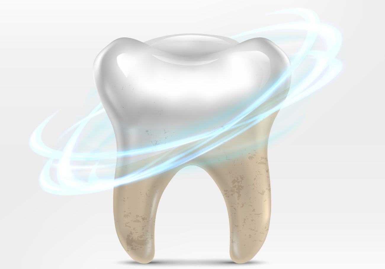 Before and after results of teeth whitening at UniqDentalClinic