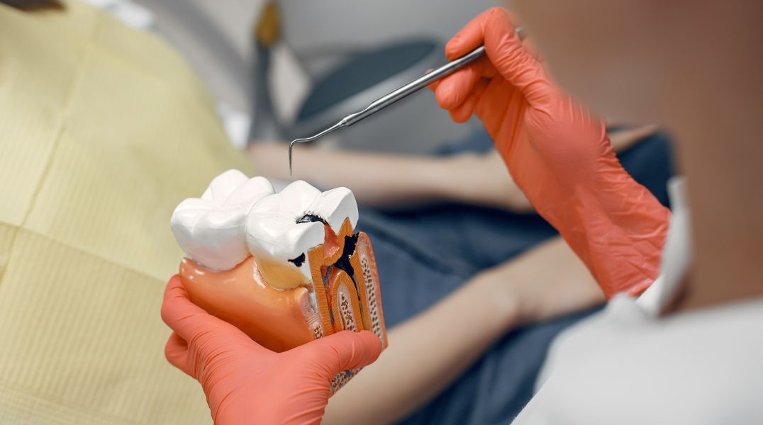 Tooth cavity filling procedure at a modern dental clinic in Coimbatore