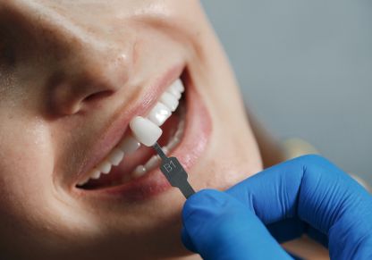 Dental veneers treatment in Coimbatore at UniqDentalClinic